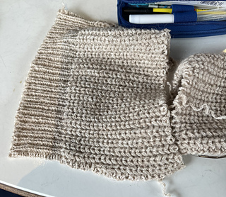 2023-12-17 original cuff amputated.