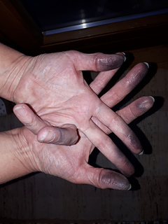 my fingers after knitting a while